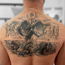 Blou Tattoo Removal Madrid