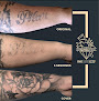 Eliminación De Tatuajes Madrid - Quitattooaveria